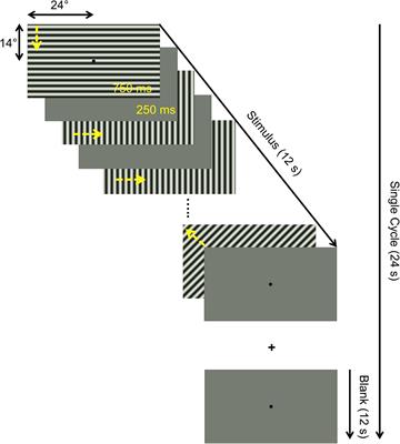 Functional Dynamics of Deafferented Early Visual Cortex in Glaucoma